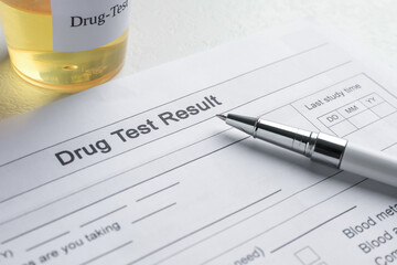Drug test result form, container with urine sample and pen on light table, closeup