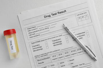 Obraz premium Drug test result form, container with urine sample and pen on light table, flat lay