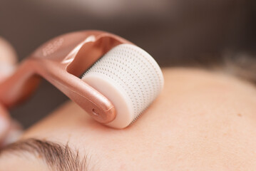Close up shot of using roller with micro needles for stimulation of skin regeneration on face of a...