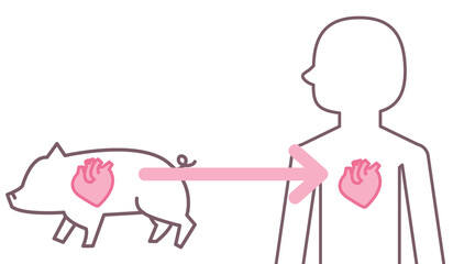 ブタからヒトへの心臓移植