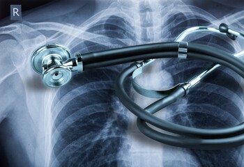 Medical Stethoscope on  X-ray photo of a patient.