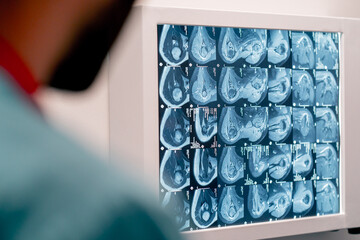 A close-up frame of an MRI image on a special board for an accurate and detailed description of image and diagnosis