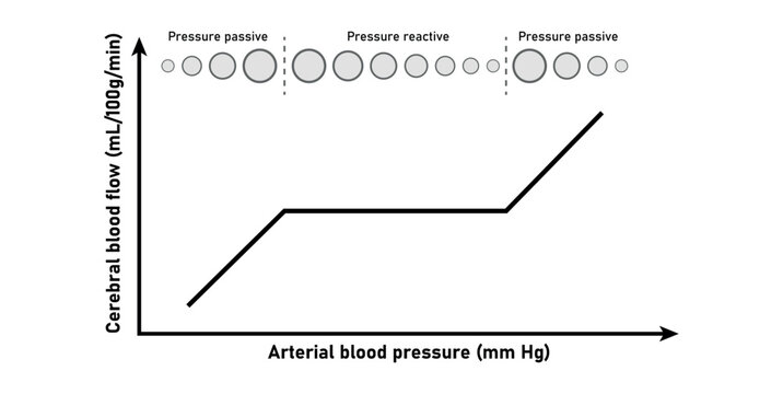 Cerebral autoregulation monitoring curve. Traumatic brain injury. Scientific resources for teachers and students.
