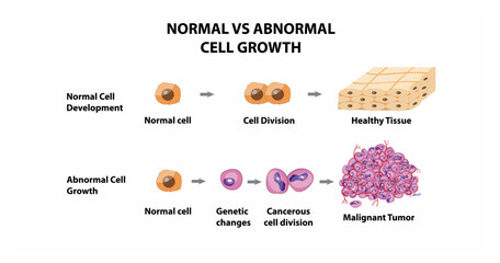 Normal vs Abnormal Cell growth and development, Vector, illustration