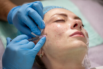 Injection facial rejuvenation. Biorevitalization and mesotherapy. A cosmetologist injects cosmetic...