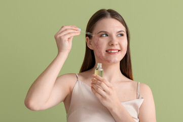 Obraz na płótnie Canvas Young woman with acne problem applying serum on green background, closeup