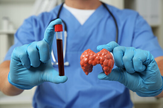 Endocrinologist showing thyroid gland model and blood sample in hospital, closeup
