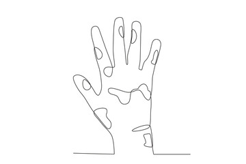 Lesions on the skin of lepers. World Leprosy Day one-line drawing