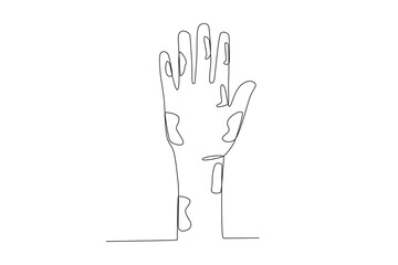 A concept of leprosy. World Leprosy Day one-line drawing