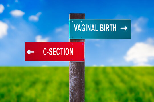 Vaginal Birth vs C-section - Traffic sign with two options - natural delivery vs Caesarean section. Deliver baby using surgery method. Question of risk, pain, maternity hospital.