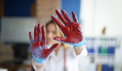 Bloodied hand in doctor medical gloves in clinic. Bleeding and methods to stop it concept - obrazy, fototapety, plakaty