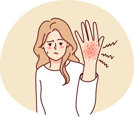 Unhappy woman suffer from rash on hand