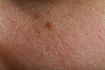 Fototapeta premium Closeup view of human skin as background