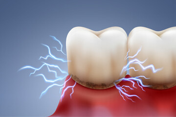Plaque and tooth sensitivity Electric sparks are like the sharp pain in your teeth caused by plaque and gum inflammation. Dental treatment and protection. Realistic vector illustration file.