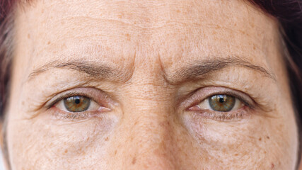 Close up of an elderly caucasian woman's face with puffiness under her eyes, facial wrinkles and...