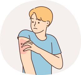 Unhealthy man scratching arm suffer from pox