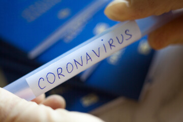 Hands holding blood test tube for Coronavirus