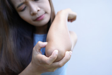 Naklejka premium Asian woman has itching on her arms.