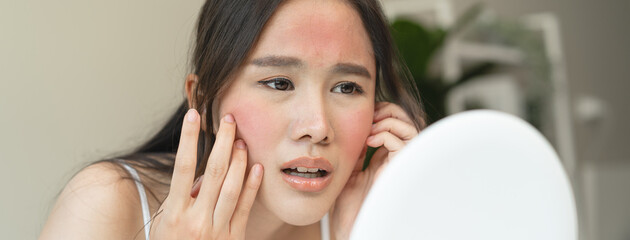 Asian young woman looking face skin in the mirror have a red rash on her face from cosmetic allergy - obrazy, fototapety, plakaty
