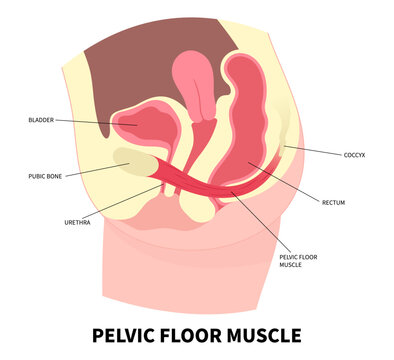 Uterine prolapse with pelvic floor muscles weakness anatomy and reproductive system the training for constipation