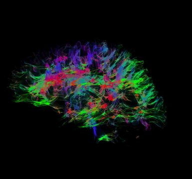 Colourful Brain of Human