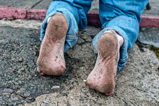 The feet of a man who has just climbed Croagh Patrick barefoot as he prays at the top.