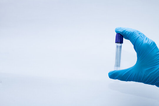 Vacuum blood collection tube with sodium citrate in blue gloves for laboratory.