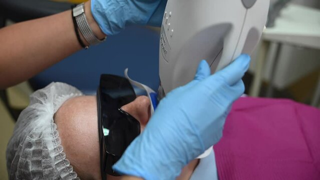 Dental Whitening process in patient mouth. Teeth whitening with UF Lamp, Led Lamp and gel. Dental Extreme Close up Macro Video. Concept of professional dental hygiene. 4k 120 fps slow motion footage