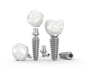 Dental implant concept design. Dental 3D illustration