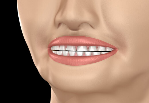Smile with Dental attrition (loss of tooth tissue). Dental 3D illustration