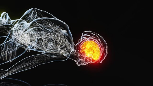 4K abstract animation of a Cyclist and a concussion