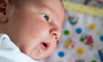 Rash on the face of a newborn baby. The process of formation of the hormonal system, close-up