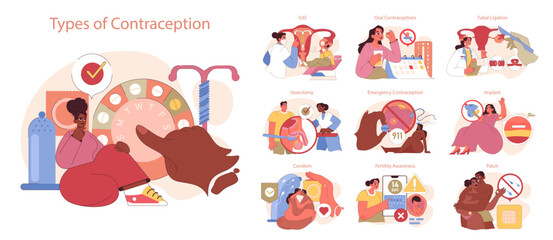 Types of Contraception set. Exploring various contraception methods, from IUDs to implants. Informative guide on birth control choices. Flat vector illustration