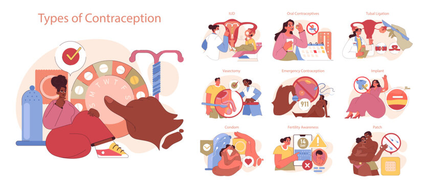 Types of Contraception set. Exploring various contraception methods, from IUDs to implants. Informative guide on birth control choices. Flat vector illustration