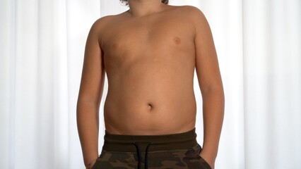 problems of overweight and obesity in children - getting married and seeing the fat accumulated in...