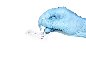 The doctor adds a reagent to the express test for detecting HIV/AIDS