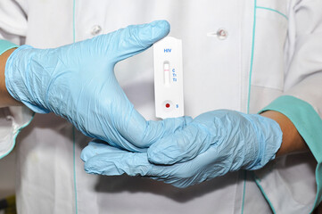 Express test for HIV/AIDS in the hands of a doctor. Close-up