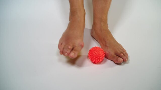Hallux valgus disease. Two feet of a woman massaged on  ball.