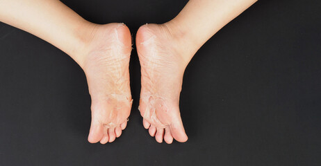 Foot peeling or remove dead skin on black background. - obrazy, fototapety, plakaty