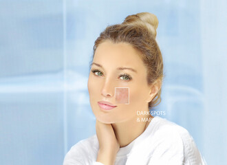 Skin solutions.Concept of rejuvenation.skin with acne scars and age spots