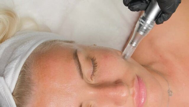 Close-up portrait of a beautiful aged woman during microneedling with dermapen from a beautician. Vertical video.