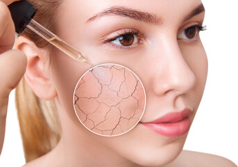 Zoom circle shows dry skin before and after applying cosmetics remedy.
