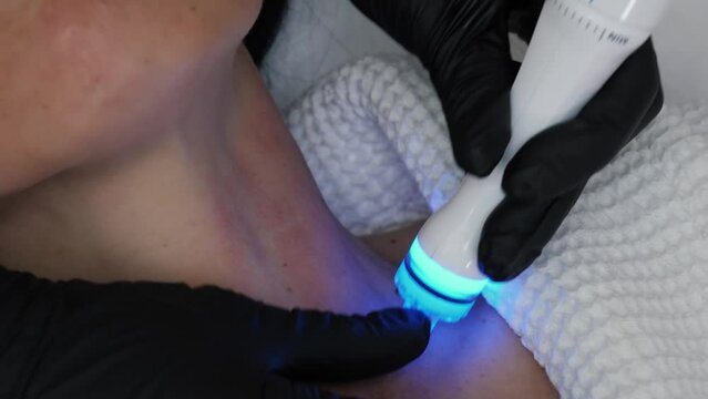 Professional moisturizing and rejuvenating hardware procedures. Vacuum cleaning and polishing neck skin of unrecognizable woman in cosmetology clinic, closeup. Non surgery cosmetology skincare
