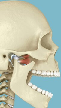 Temporomandibular joints and dislocated articular disc. Medically accurate 3D animation
