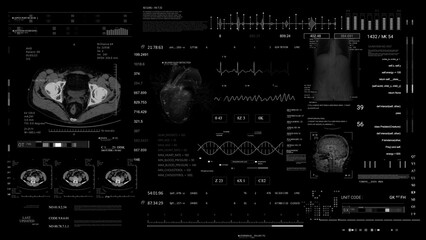 Medical HUD monitoring MRI x ray CT Scan. Healthcare.Heart rate monitor. Futuristic Technological Interface. Sceleton, 3D Model Animation.Black Background