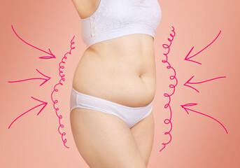 White outlines with arrows around fat body of young woman. - obrazy, fototapety, plakaty