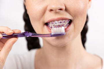 Close-up of young woman brushing her teeth with brackets using manual toothbrush. Concept of dental...