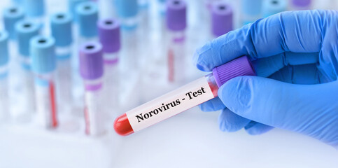 Doctor holding a test blood sample tube with Norovirus test on the background of medical test tubes...