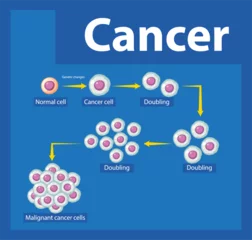 Deurstickers Processing of Cancer Cells: An Infographic Exploration © GraphicsRF