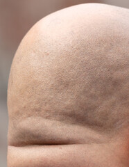 A man has a bald head. Close-up